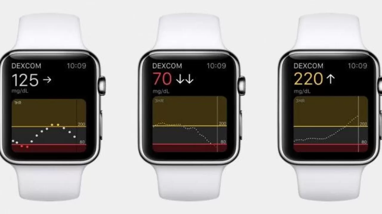 Apple-Watch-Kan-Sekeri-Olcum-Sensoru.webp