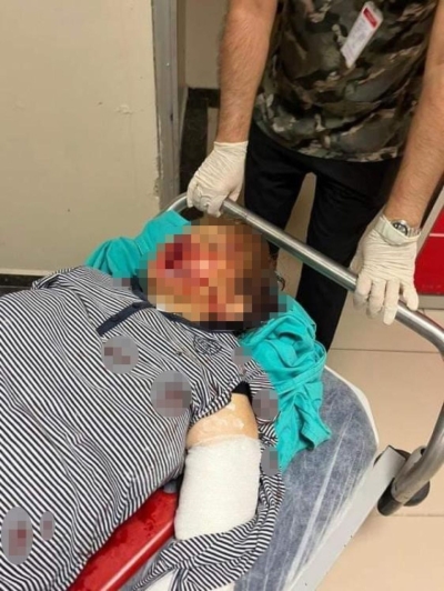 Torundan dede ve babaannesine öldüresiye dayak