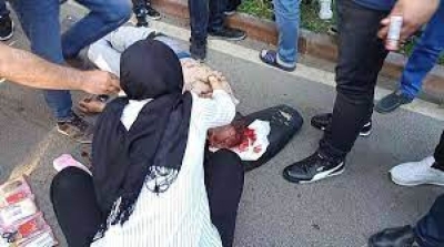 Fuzuli Caddesi’nde otomobil motosiklet ile çarpıştı: 1 ölü